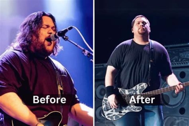Wolfgang Van Halen Weight Loss Photos: A Journey Of Transformation